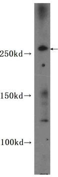 CEP290 Rabbit Polyclonal Antibody