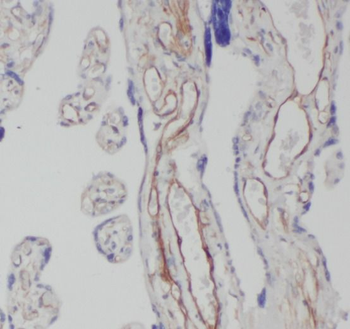 CEP290 Rabbit Polyclonal Antibody