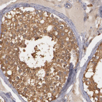 CEP55 Rabbit Polyclonal Antibody