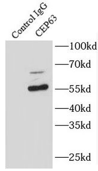 CEP63 Rabbit Polyclonal Antibody