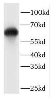CEP63 Rabbit Polyclonal Antibody
