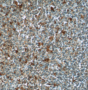 CEP63 Rabbit Polyclonal Antibody