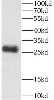 CEP70 Rabbit Polyclonal Antibody