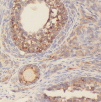 CEP70 Rabbit Polyclonal Antibody