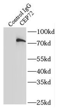 CEP72 Rabbit Polyclonal Antibody