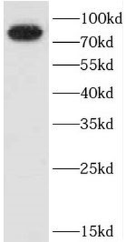 CEP72 Rabbit Polyclonal Antibody