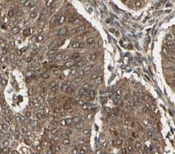 CEPT1 Rabbit Polyclonal Antibody