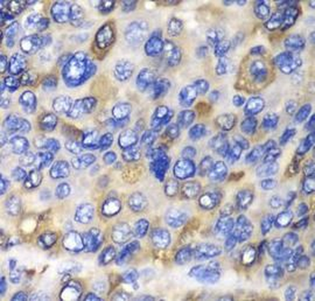 CES1 Rabbit Polyclonal Antibody