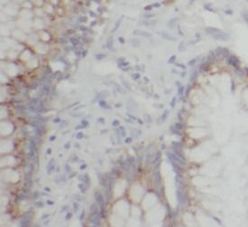 CES2 Rabbit Polyclonal Antibody