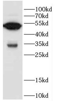 CFLAR Rabbit Polyclonal Antibody