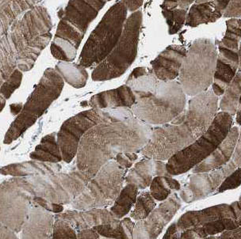 CFLAR Rabbit Polyclonal Antibody