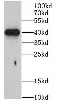 CHAD Rabbit Polyclonal Antibody