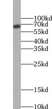 CHAT Rabbit Polyclonal Antibody