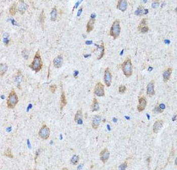 CHAT Rabbit Polyclonal Antibody
