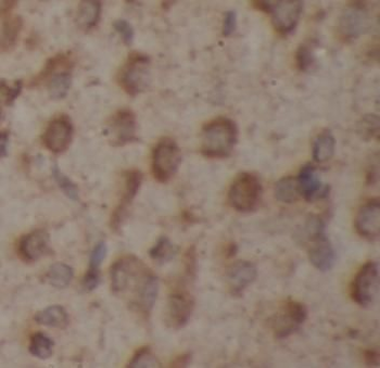 CHAT Rabbit Polyclonal Antibody