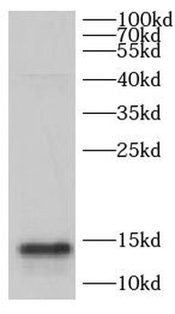 CHCHD10 Rabbit Polyclonal Antibody