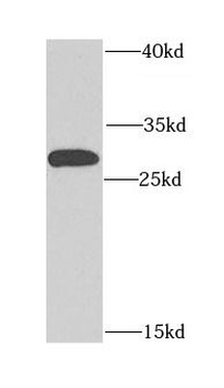 CHCHD3 Rabbit Polyclonal Antibody