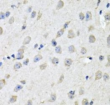CHCHD3 Rabbit Polyclonal Antibody