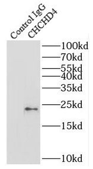 CHCHD4 Rabbit Polyclonal Antibody