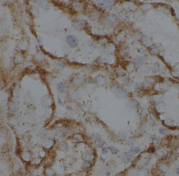 CHCHD4 Rabbit Polyclonal Antibody