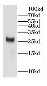 CHCHD6 Rabbit Polyclonal Antibody