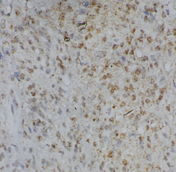 CHCHD6 Rabbit Polyclonal Antibody