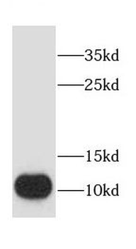 CHCHD7 Rabbit Polyclonal Antibody