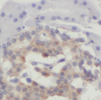 CHCHD7 Rabbit Polyclonal Antibody