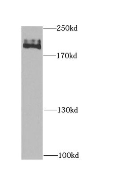 CHD1 Rabbit Polyclonal Antibody