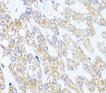 CHD1 Rabbit Polyclonal Antibody