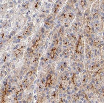 CHDH Rabbit Polyclonal Antibody