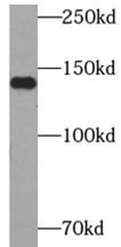 CHERP Rabbit Polyclonal Antibody