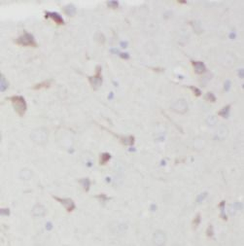 CHERP Rabbit Polyclonal Antibody