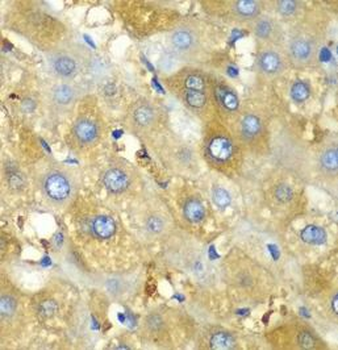 CHIA Rabbit Polyclonal Antibody