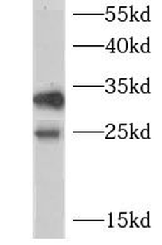 CHMP1A Rabbit Polyclonal Antibody