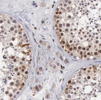 CHMP1A Rabbit Polyclonal Antibody