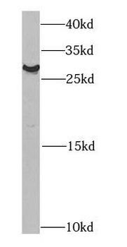 CHMP2B Antibody