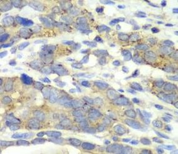 CHMP2B Antibody