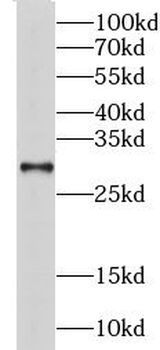 CHMP6 Rabbit Polyclonal Antibody