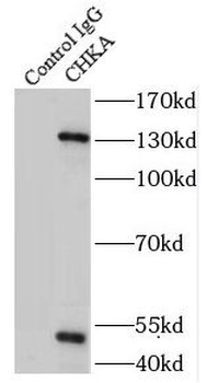 CHKA Rabbit Polyclonal Antibody