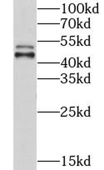 CHKA Rabbit Polyclonal Antibody