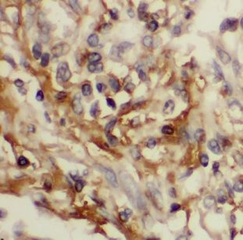 CHKA Rabbit Polyclonal Antibody