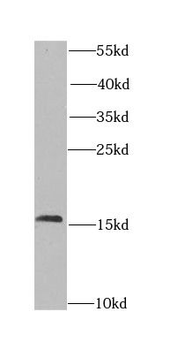 CHRAC1 Rabbit Polyclonal Antibody