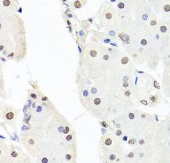 CHRAC1 Rabbit Polyclonal Antibody