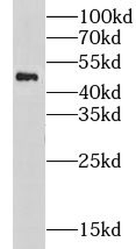 CHRNA10 Rabbit Polyclonal Antibody