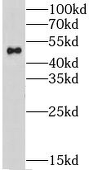 CHRNA3 Rabbit Polyclonal Antibody
