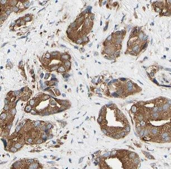 CHRNA3 Rabbit Polyclonal Antibody