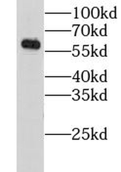 CHRNA6 Rabbit Polyclonal Antibody