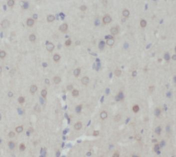 CHRNA7 Rabbit Polyclonal Antibody
