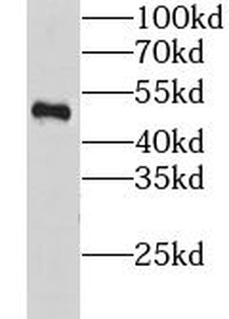 CHRNA9 Rabbit Polyclonal Antibody